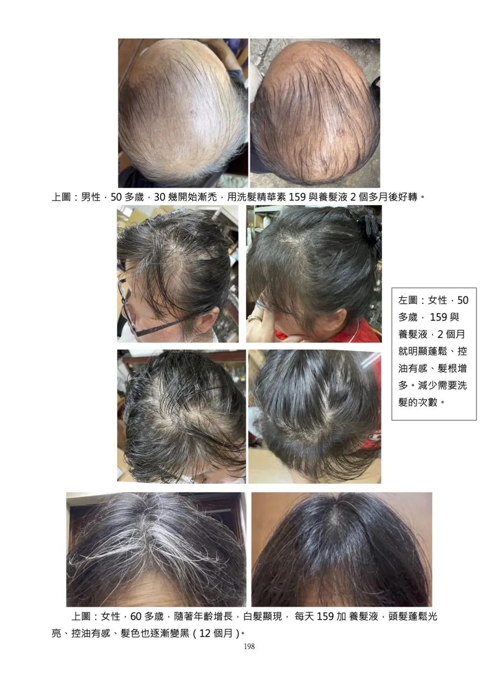 ALL_product_25L24_n2Mlh4pil2
